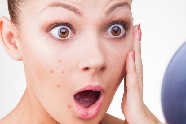 shocked woman looking in mirror at her pimples